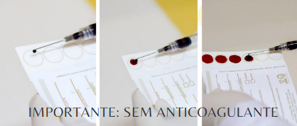 Procedimento Alerta de Coleta Venosa